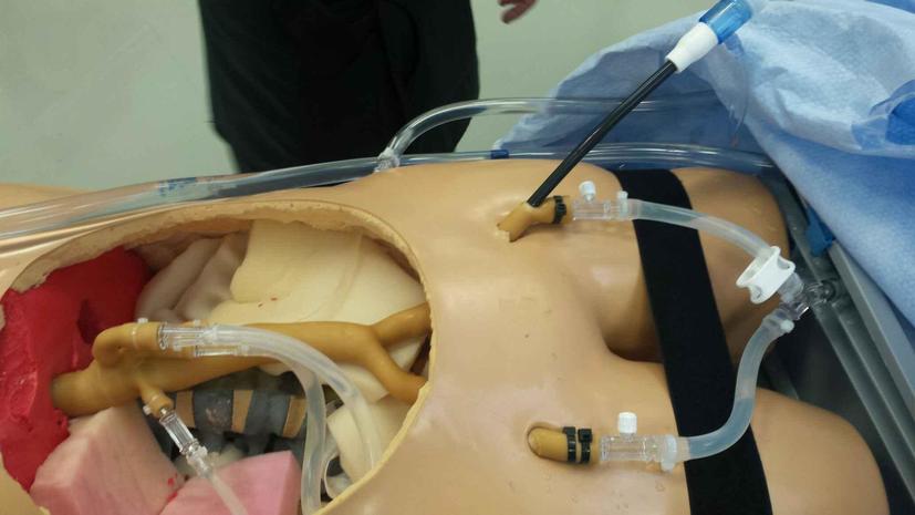 fevar-aortic-realistic-3d-printed-model-training-surgeons-1